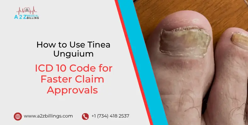 How to Use Tinea Unguium ICD 10 Code for Faster Claim Approvals